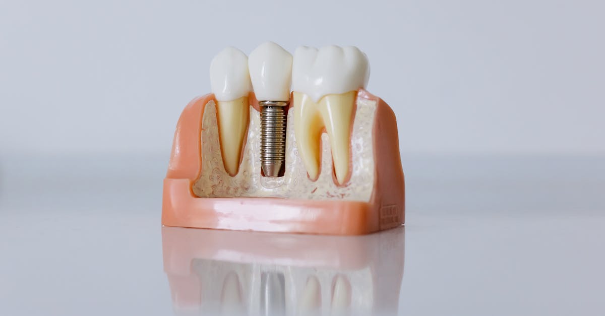 découvrez l'orthodontie, une discipline dentaire spécialisée dans le diagnostic et le traitement des malpositions dentaires et des dysfonctionnements de la mâchoire. obtenez des conseils d'experts pour un sourire sain et esthétique.