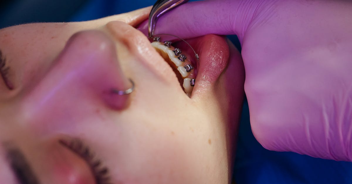 découvrez l'univers de l'orthodontie, une spécialité dentaire dédiée à l'amélioration de l'alignement des dents et des mâchoires. apprenez-en plus sur les traitements innovants, du port d'appareils dentaires traditionnels aux solutions invisibles modernes. offrez à votre sourire la confiance qu'il mérite grâce à l'expertise des orthodontistes.