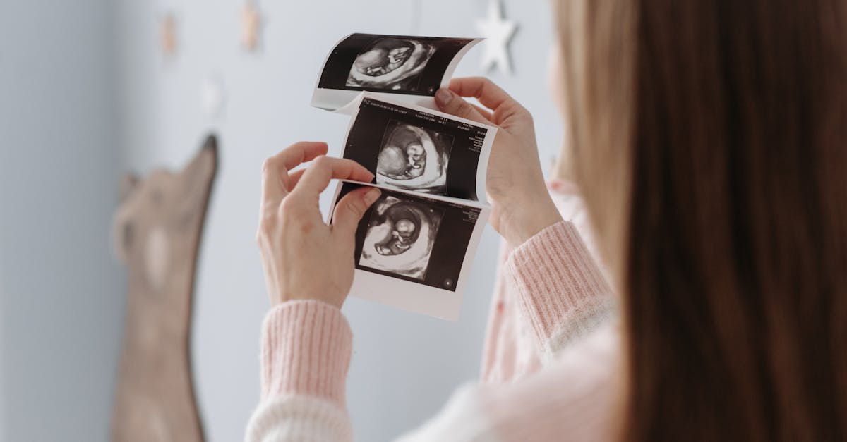 découvrez tout ce qu'il faut savoir sur le congé maternité : durée, démarches, droits, indemnisation et conseils pour bien préparer votre absence avant et après l'arrivée de votre bébé.