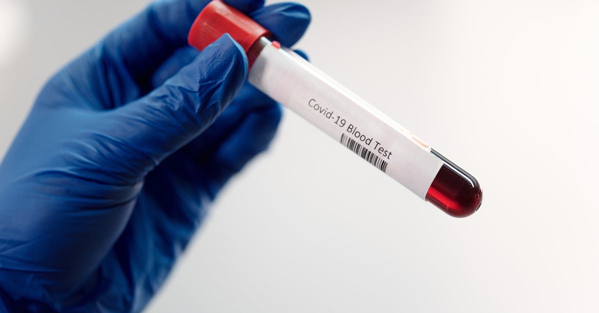 découvrez le métier de test technician : responsabilités, compétences requises et opportunités de carrière dans le domaine du contrôle qualité et des tests industriels.